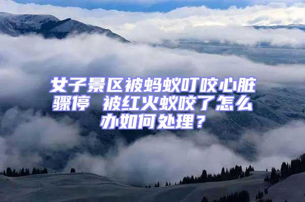 女子景區被螞蟻叮咬心臟驟停 被紅火蟻咬了怎么辦如何處理？