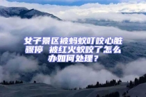 女子景區被螞蟻叮咬心臟驟停 被紅火蟻咬了怎么辦如何處理？